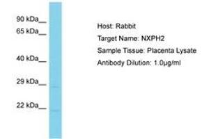 Image no. 1 for anti-Neurexophilin 2 (NXPH2) (AA 161-210) antibody (ABIN6750586) (NXPH2 antibody  (AA 161-210))