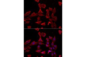 Immunofluorescence analysis of HeLa cell using ADSS antibody. (ADSS antibody)