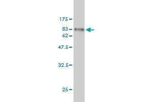 Western Blot detection against Immunogen (67. (FGFR1OP antibody  (AA 1-379))