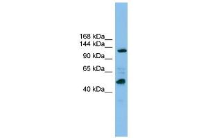 POLR1B antibody used at 1 ug/ml to detect target protein.