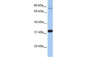 TIPIN antibody used at 0. (TIPIN antibody  (Middle Region))