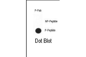 Dot blot analysis of anti-Phospho-CDX2 Phospho-specific Pab (ABIN650838 and ABIN2839803)? (CDX2 antibody  (pSer283))