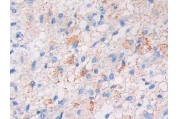LPCAT3 antibody  (AA 122-233)