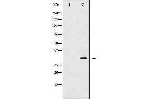 Western blot analysis of 14-3-3 zeta/ delta phosphorylation expression in UV treated Jurkat whole cell lysates,The lane on the left is treated with the antigen-specific peptide. (14-3-3 zeta antibody  (pThr232))