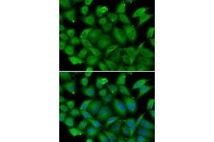 Immunofluorescence analysis of HeLa cells using DEFA1 antibody (ABIN5974152). (alpha Defensin 1 antibody)