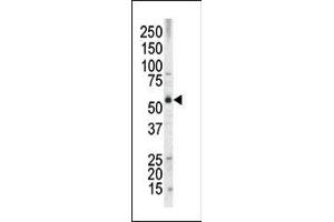 The anti-MLLT3 Pab (ABIN390130 and ABIN2840635) is used in Western blot to detect MLLT3 in HL60 tissue lysate (AF9 antibody  (N-Term))