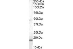 ABIN334357 (0. (BAALC antibody  (Internal Region))