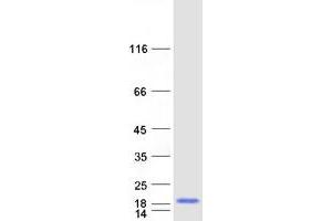Validation with Western Blot (C10ORF35 Protein (Myc-DYKDDDDK Tag))