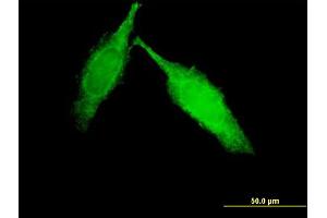 anti-Immunoglobulin-Like and Fibronectin Type III Domain Containing 1 (IGFN1) (AA 720-818) antibody