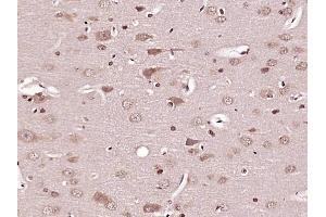 Paraformaldehyde-fixed, paraffin embedded Rat brain Antigen retrieval by boiling in sodium citrate buffer (pH6. (Caspase 6 antibody  (AA 181-293))