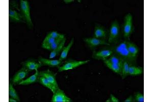 Immunofluorescent analysis of Hela cells using ABIN7145158 at dilution of 1:100 and Alexa Fluor 488-congugated AffiniPure Goat Anti-Rabbit IgG(H+L) (B-Cell Linker antibody  (AA 41-337))