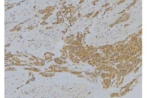 ABIN6272872 at 1/100 staining Human lung tissue by IHC-P. (Sulfiredoxin 1 antibody  (Internal Region))