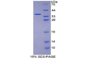 SDS-PAGE (SDS) image for Keratin 1 (KRT1) (AA 189-497) protein (His tag) (ABIN1080126)