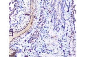 IHC analysis of INPPL1 using anti-INPPL1 antibody (ABIN6719492). (INPPL1 antibody  (AA 1172-1258))