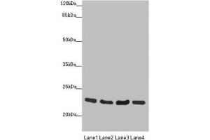 RAB18 antibody  (AA 1-206)