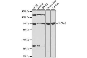 Western blot analysis of extracts of various cell lines, using SLC1A2 antibody (ABIN2736671) at 1:1000 dilution.