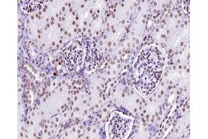 ABIN6267312 at 1/200 staining human kidney tissue sections by IHC-P. (LCK antibody  (pTyr505))