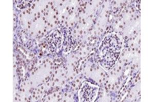 ABIN6267312 at 1/200 staining human kidney tissue sections by IHC-P. (LCK antibody  (pTyr505))