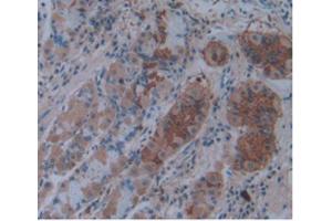 IHC-P analysis of Human Stomach Tissue, with DAB staining. (IL1A antibody  (AA 113-271))