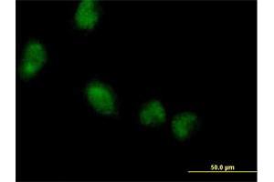Immunofluorescence of purified MaxPab antibody to LMCD1 on HeLa cell. (LMCD1 antibody  (AA 1-365))
