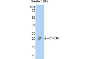 Detection of Recombinant CFP, Mouse using Polyclonal Antibody to Complement Factor P (CFP) (CFP antibody  (AA 310-459))