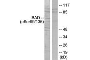 Western blot analysis of extracts from NIH-3T3 cells treated with Forskolin, using BAD (Phospho-Ser136) Antibody. (BAD antibody  (pSer99))
