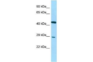 Host: Rabbit Target Name: DNAJC8 Sample Type: Jurkat Whole Cell lysates Antibody Dilution: 1. (DNAJC8 antibody  (C-Term))