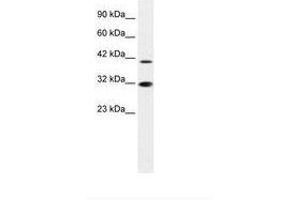 Image no. 1 for anti-Interferon Regulatory Factor 2 (IRF2) (AA 52-101) antibody (ABIN6735872) (IRF2 antibody  (AA 52-101))