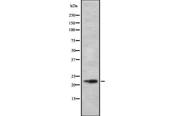 CALY antibody  (Internal Region)