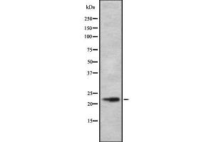 Western blot analysis of DRD1IP using RAW264. (CALY antibody  (Internal Region))