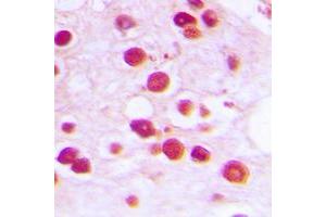 Immunohistochemical analysis of ZNF232 staining in human testis formalin fixed paraffin embedded tissue section. (ZNF232 antibody  (Center))