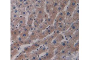 #VALUE! (RND1 antibody  (AA 1-229))