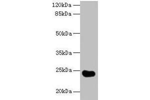 Western blot All lanes: GGTLC2 antibody at 2 μg/mL + Mouse kidney tissue Secondary Goat polyclonal to rabbit IgG at 1/10000 dilution Predicted band size: 24 kDa Observed band size: 24 kDa (GGTLC2 antibody  (AA 1-218))