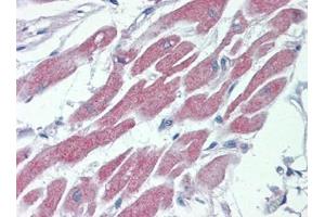 Human Heart: Formalin-Fixed, Paraffin-Embedded (FFPE) (STK39 antibody  (C-Term))