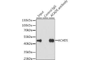 Immunoprecipitation analysis of 200 μg extracts of MCF-7 cells, using 3 μg ACADS antibody (ABIN6129346, ABIN6136401, ABIN6136402 and ABIN6223064). (ACADS antibody  (AA 1-260))