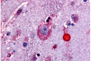 Anti-Delta Opioid Receptor antibody  ABIN1048496 IHC staining of human brain. (OPRD1 antibody  (Extracellular Domain))