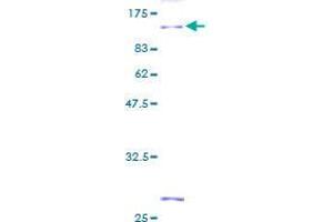 FERMT2 Protein (AA 1-680) (GST tag)