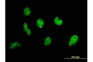 Immunofluorescence of purified MaxPab antibody to EP400 on HeLa cell. (EP400 antibody  (AA 1-985))