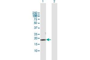 Western Blot analysis of CMTM3 expression in transfected 293T cell line by CMTM3 MaxPab polyclonal antibody.