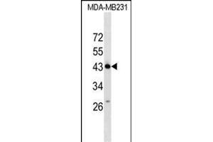 ZN Antibody (N-term) (ABIN1539540 and ABIN2849490) western blot analysis in MDA-M cell line lysates (35 μg/lane).