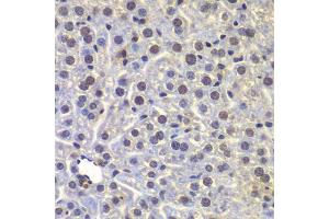 Immunohistochemistry of paraffin-embedded mouse liver using FUBP3 antibody.