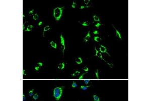 Immunofluorescence analysis of MCF-7 cells using APOBEC3G Polyclonal Antibody (APOBEC3G antibody)
