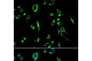 Immunofluorescence analysis of MCF-7 cells using APOBEC3G Polyclonal Antibody (APOBEC3G antibody)