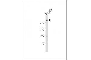 Western blot testing of LRRK2 antibody at 1:1000 dilution + human brain lysate (LRRK2 antibody  (C-Term))