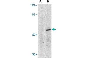Western blot analysis of IRF8 in human thymus tissue lysate with IRF8 polyclonal antibody at 1 ug/mL in (A) the presence and (B) absence of blocking peptide. (IRF8 antibody  (C-Term))