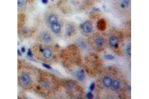 Used in DAB staining on fromalin fixed paraffin-embedded Liver tissue (CSTA antibody  (AA 1-98))
