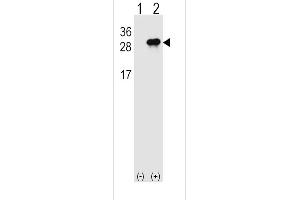 Western blot analysis of IL28B (arrow) using rabbit polyclonal IL28B Antibody (N-term) (ABIN1539309 and ABIN2848533).