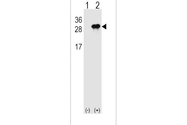 IL28B anticorps  (N-Term)
