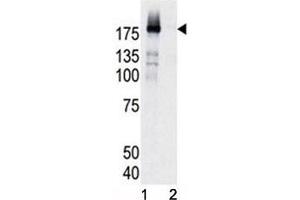 Western blot analysis of phospho-EGFR antibody and HeLa cell lysate, either induced (Lane 1) or noninduced with EGF (2).