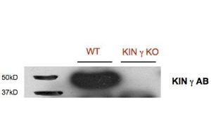 Western Blotting (WB) image for anti-SNF1-Related Protein Kinase Regulatory Subunit gamma 1 (KING1) (Regulatory Subunit Gamma) antibody (ABIN5326729) (KING1 antibody  (Regulatory Subunit Gamma))